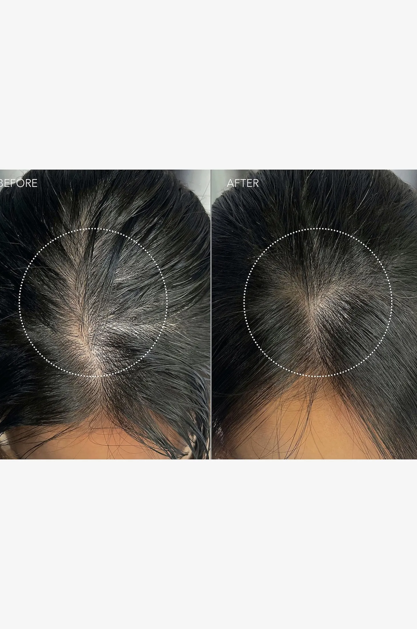 LUNA™ Dual-Peptide Scalp Serum 60Ml